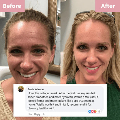Ivora™ Collagen Night Wrapping Mask