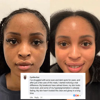 Ivora™ Collagen Night Wrapping Mask