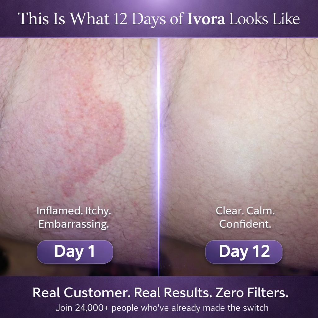 Ivora™ Antifungal Soap