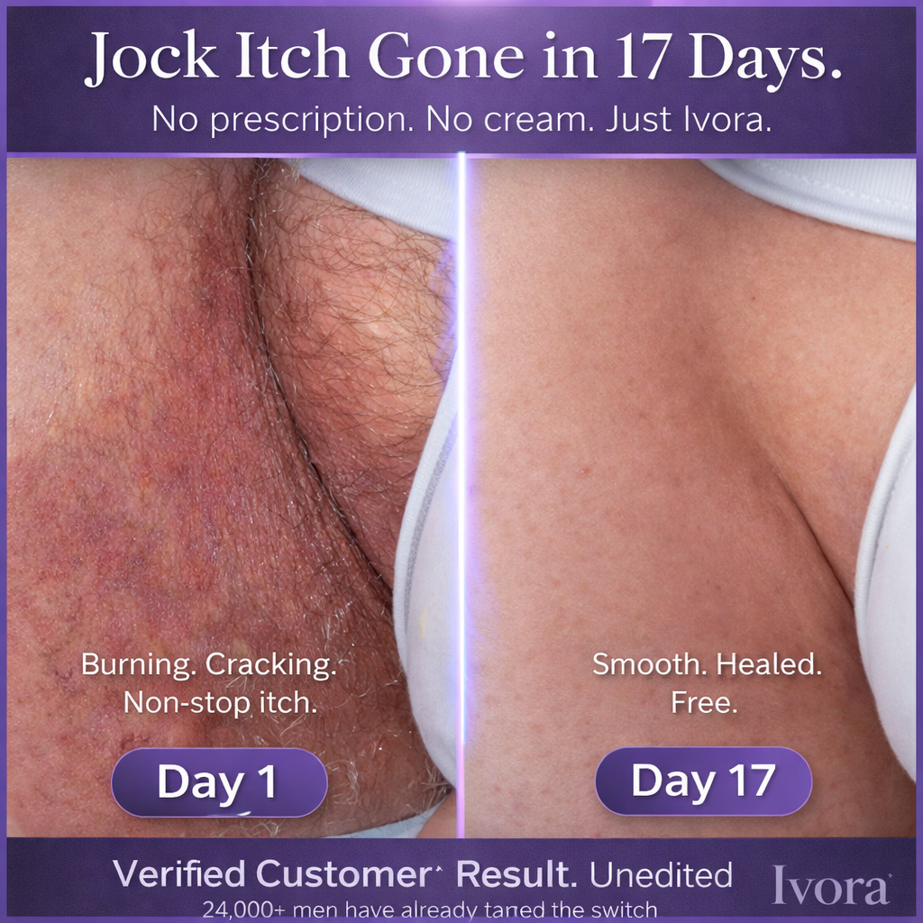 Ivora™ Antifungal Soap